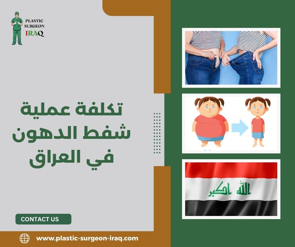 تكلفة عملية شفط الدهون في العراق