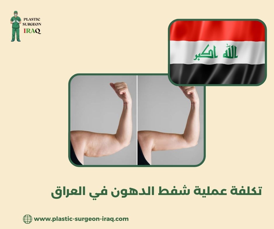 تكلفة عملية شفط الدهون في العراق