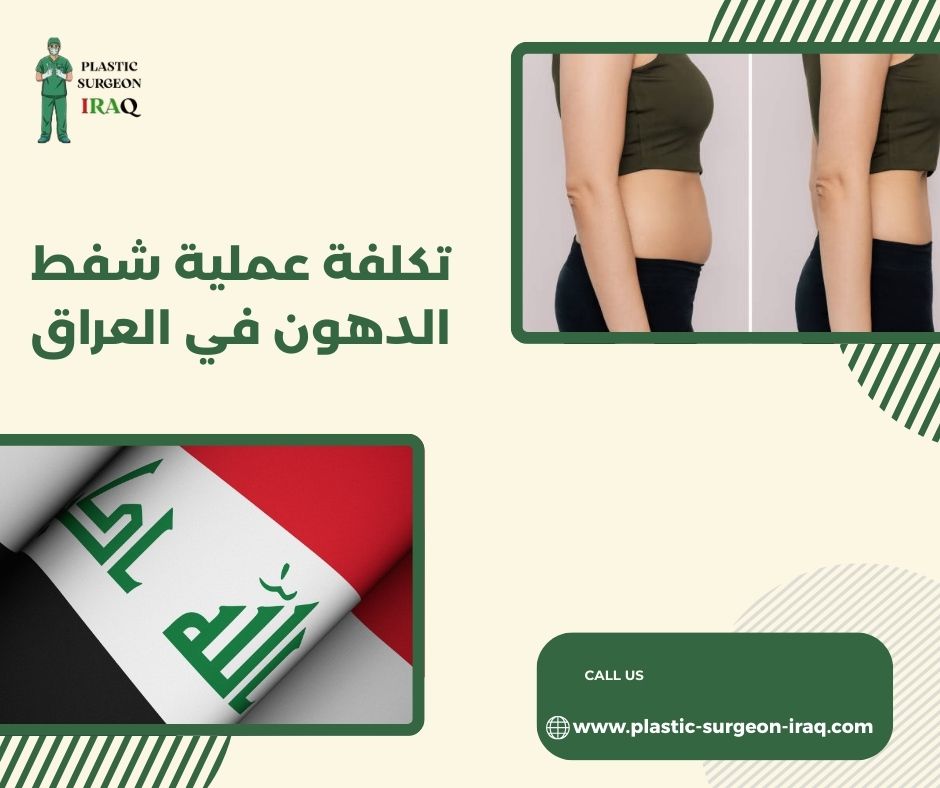 تكلفة عملية شفط الدهون في العراق
