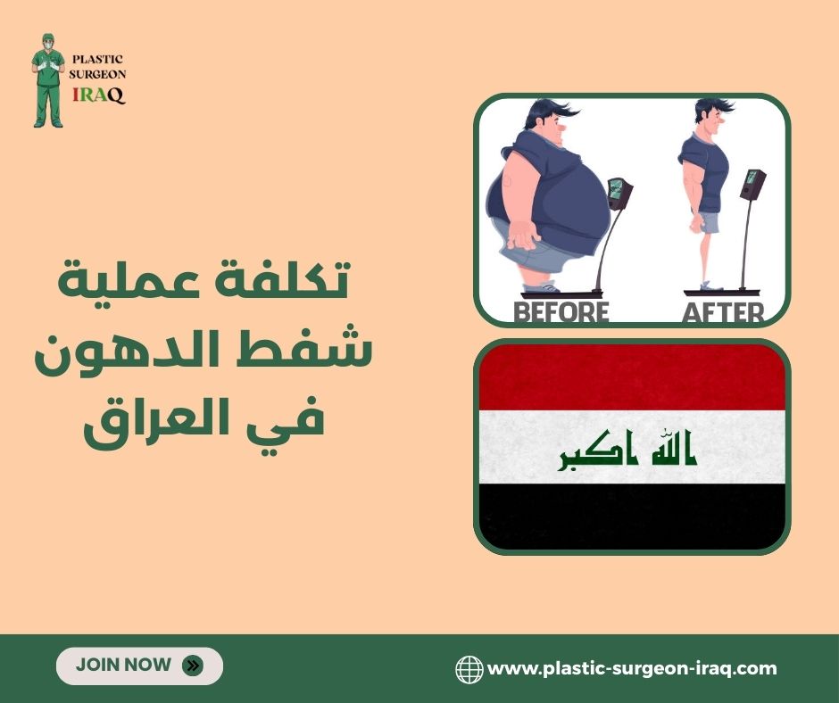 تكلفة عملية شفط الدهون في الأردن