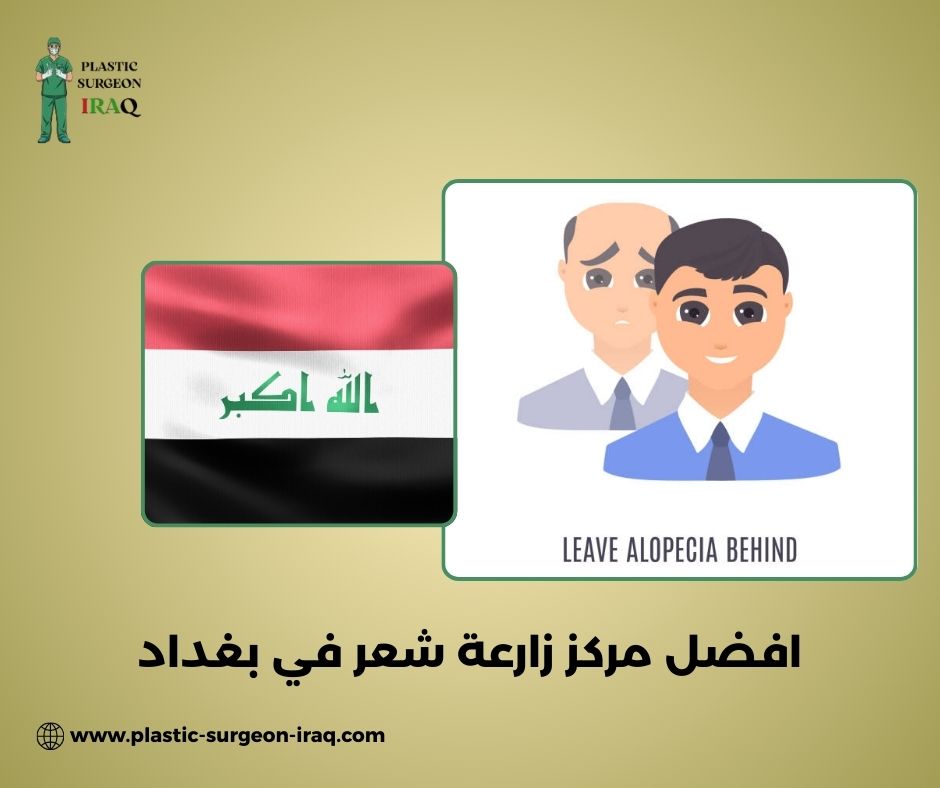 زراعة شعر بغداد