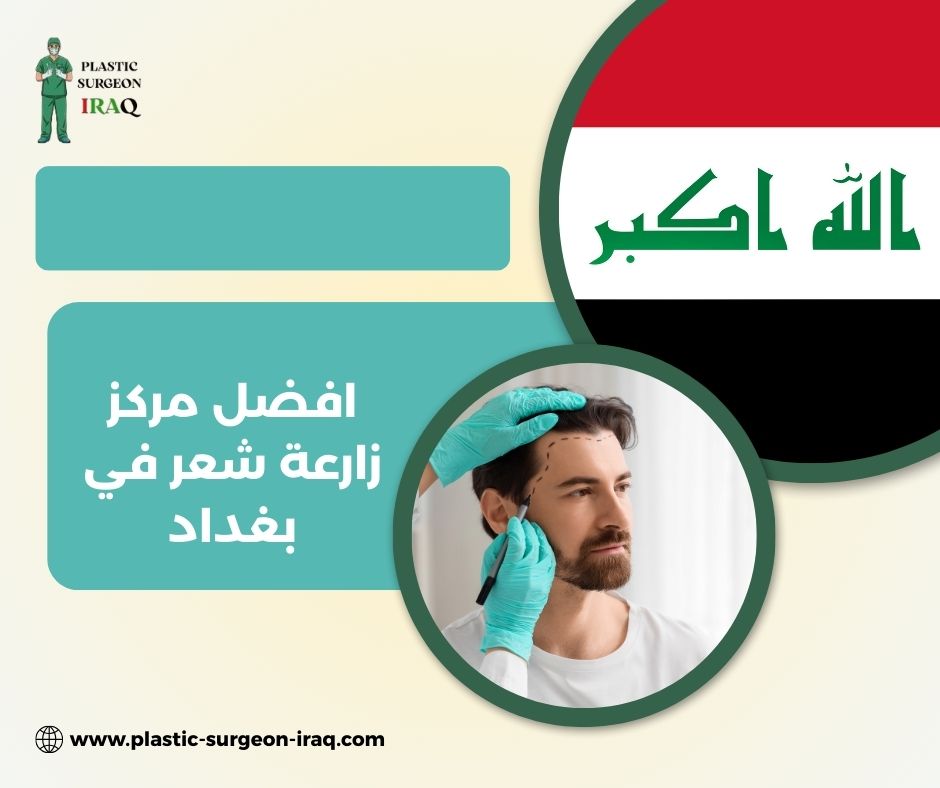 افضل مركز زارعة شعر في بغداد