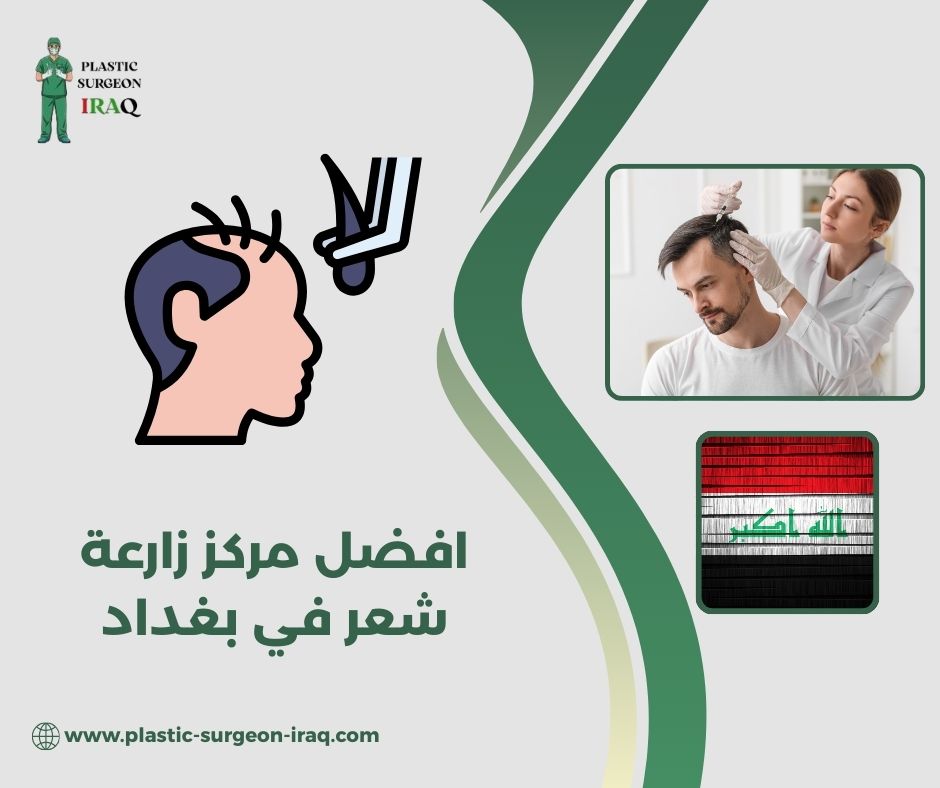 افضل مركز زارعة شعر في بغداد