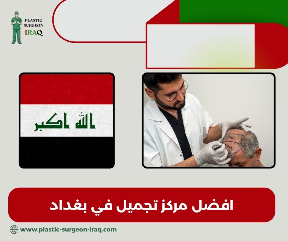 مركز تجميل في بغداد زيونة