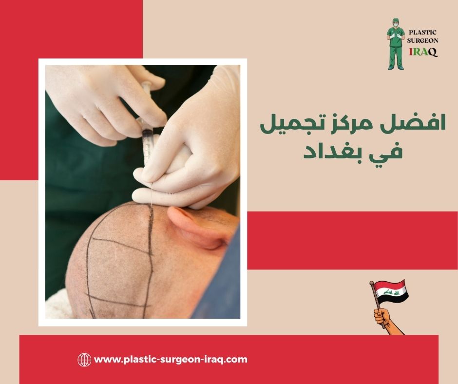 مركز تجميل في بغداد المنصور