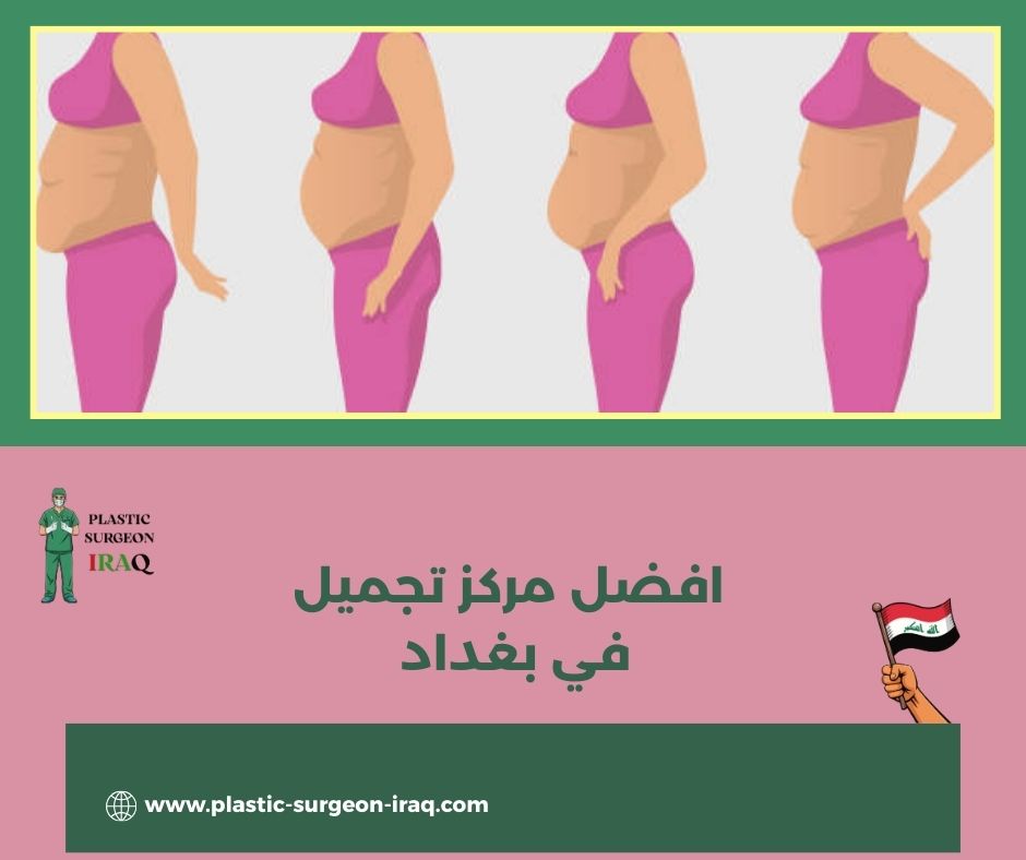 مركز تجميل في بغداد