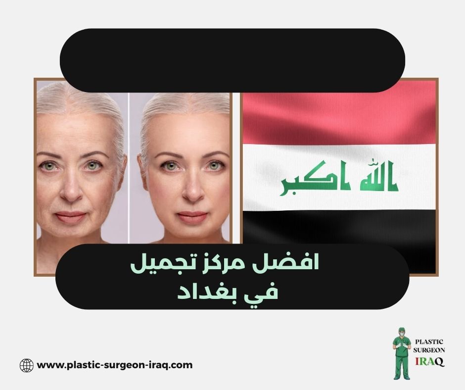 افضل مركز تجميل في بغداد