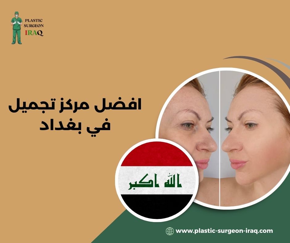 افضل مركز تجميل في بغداد