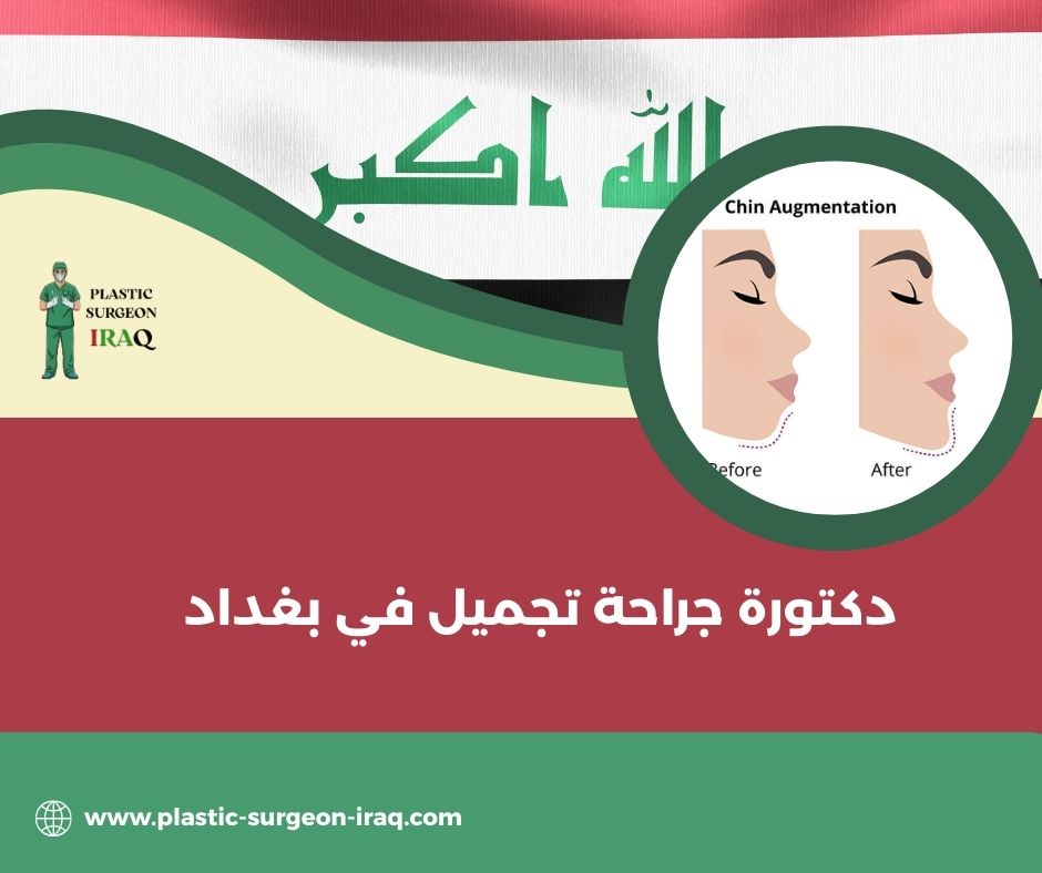 دكتور تجميل في المنصور
