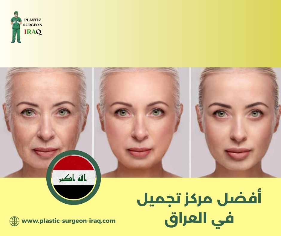 مركز تجميل في بغداد مركز تجميل في بغداد