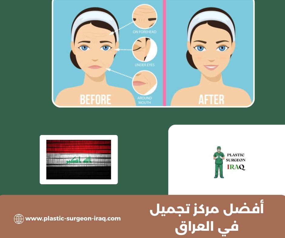 أفضل مركز تجميل في العراق أفضل مركز تجميل في العراق