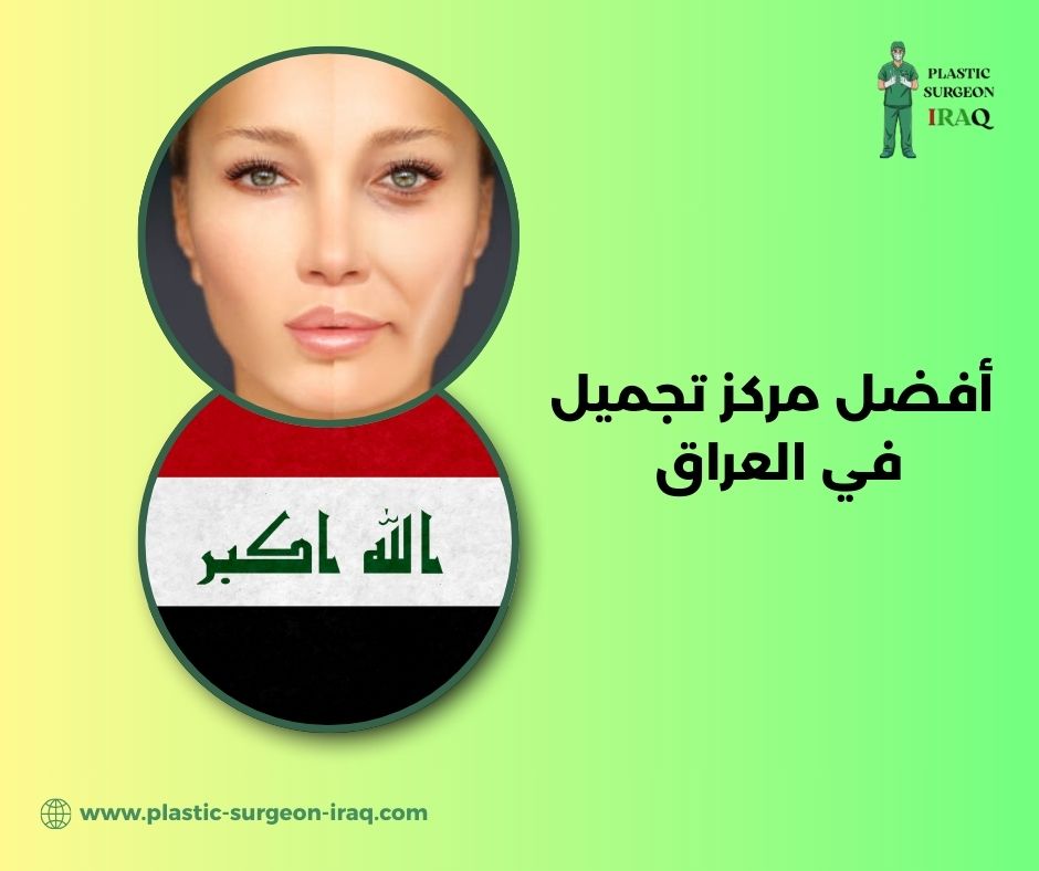 هل يعتبر حقن اليوتوكس والفيلر عملية تجميل؟ هل يعتبر حقن اليوتوكس والفيلر عملية تجميل؟