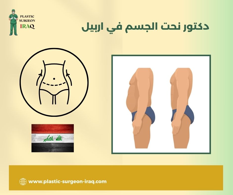 دكتور نحت الجسم في اربيل
