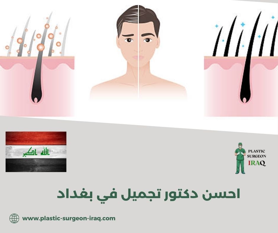 ما هو المستوى الأكاديمي والخبرة المهنية لاحسن دكتور تجميل في بغداد؟