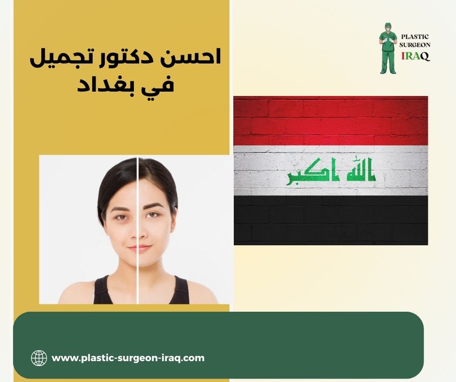 احسن دكتور تجميل في بغداد