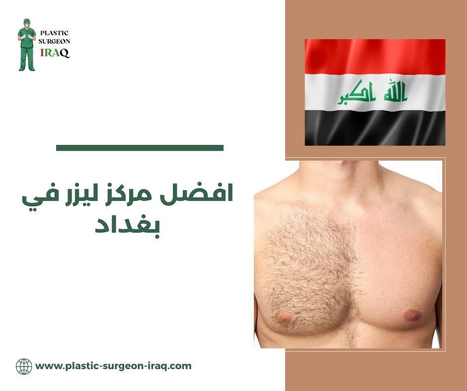 افضل مركز ليزر في بغداد