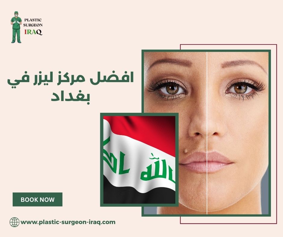 مركز ليزر في بغداد