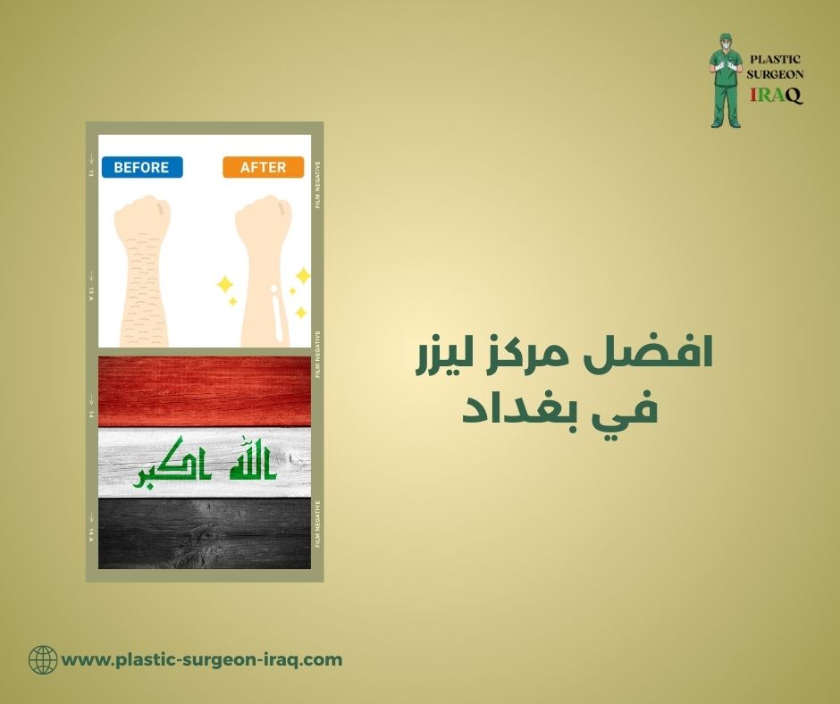 أفضل مركز ليزر في بغداد
