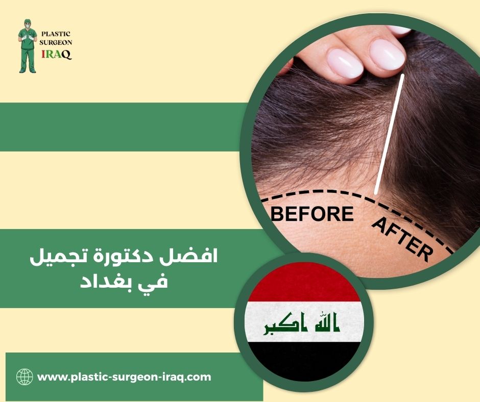 افضل دكتورة تجميل في بغداد