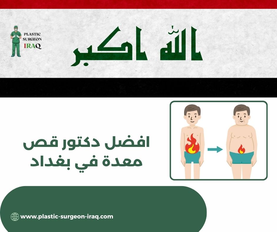 دكتور قص معده في بغداد