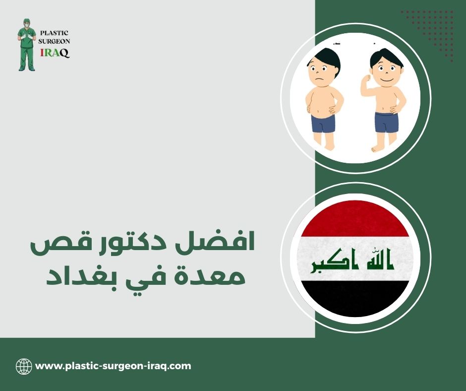 افضل دكتور قص معدة في بغداد