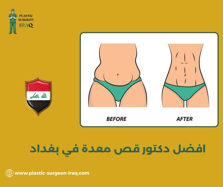 دكتور قص معدة في اربيل