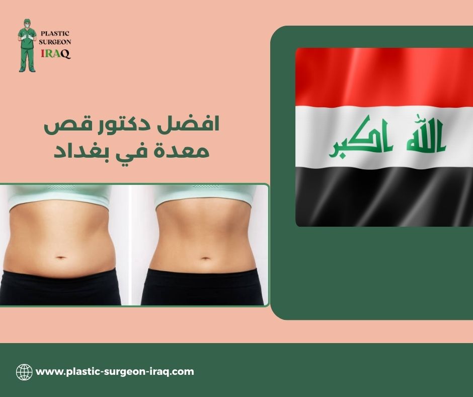 من هو افضل دكتور قص معدة في بغداد؟