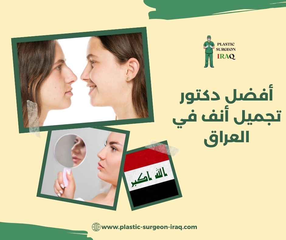 أفضل دكتور تجميل أنف في العراق