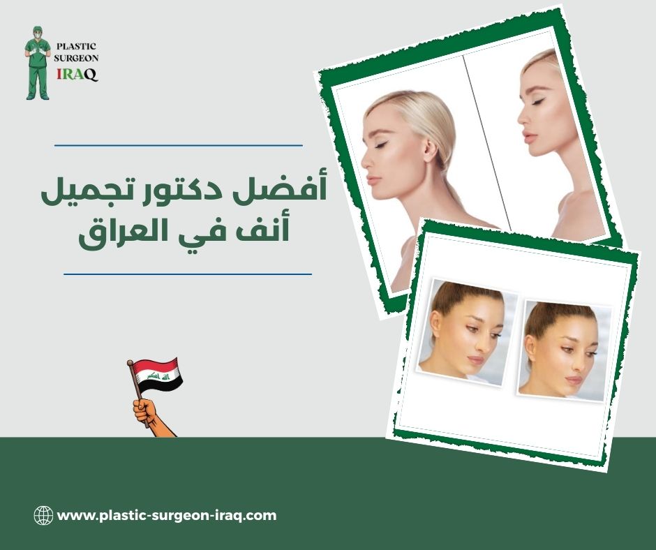 أفضل دكتور تجميل أنف في العراق
