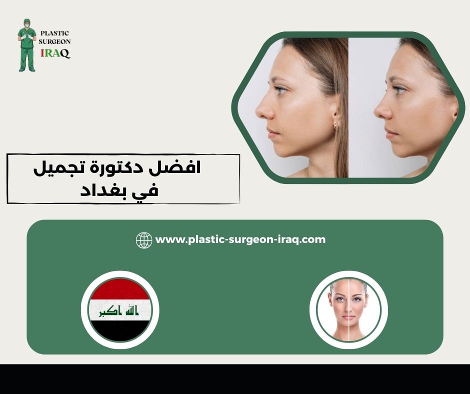 افضل دكتورة تجميل في بغداد