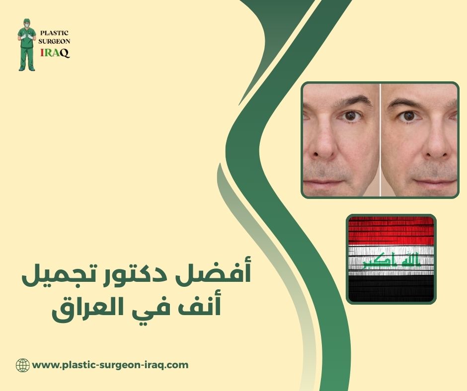 أفضل دكتور تجميل في العراق