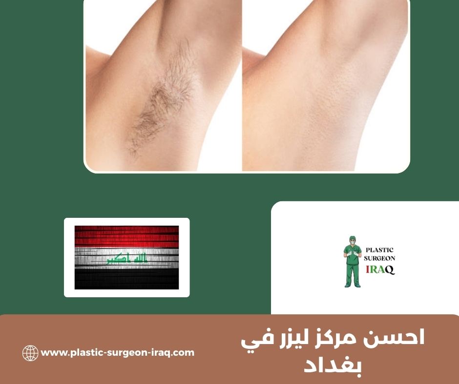 أفضل مركز ليزر في بغداد أفضل مركز ليزر في بغداد