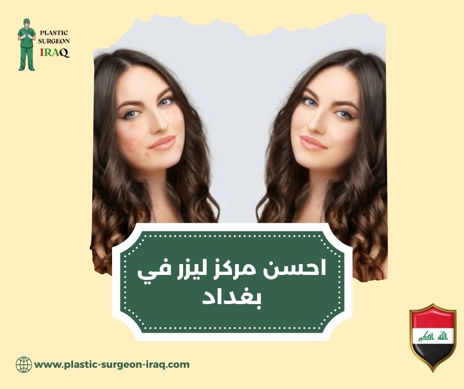مراكز ليزر في بغداد مراكز ليزر في بغداد