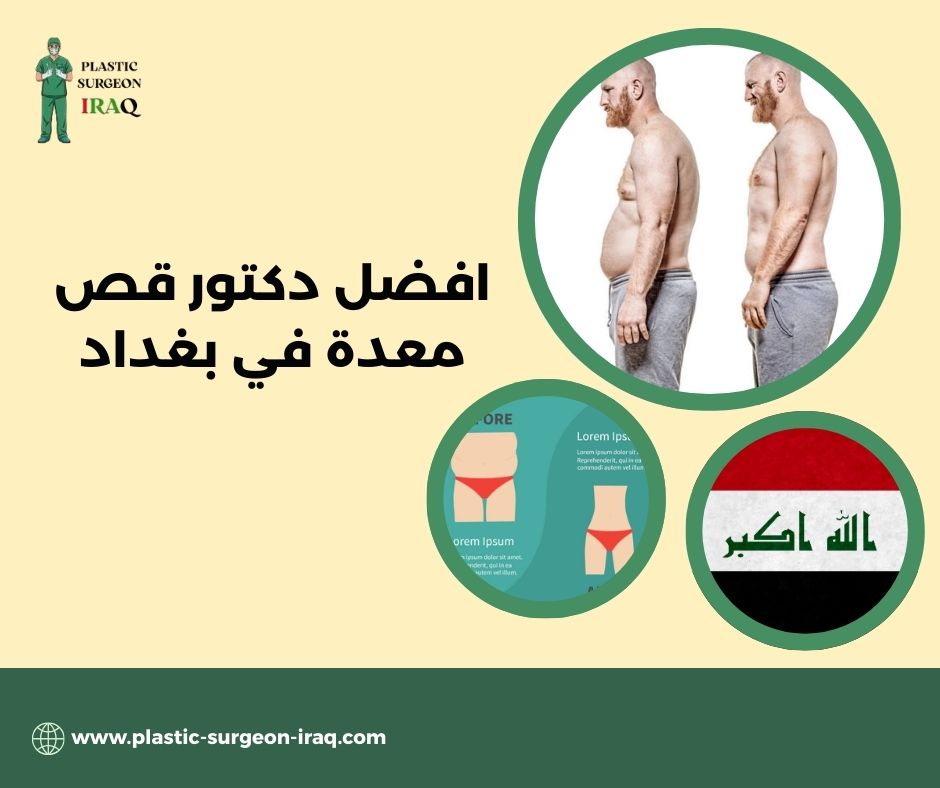 افضل دكتور قص معدة في بغداد