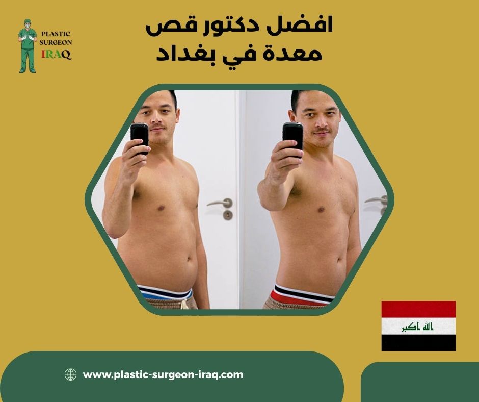 افضل دكتور قص معدة في بغداد