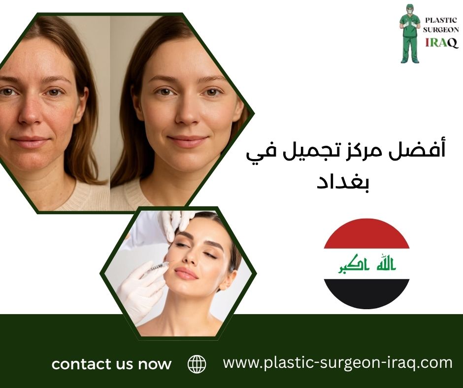 أفضل مركز تجميل في بغداد
