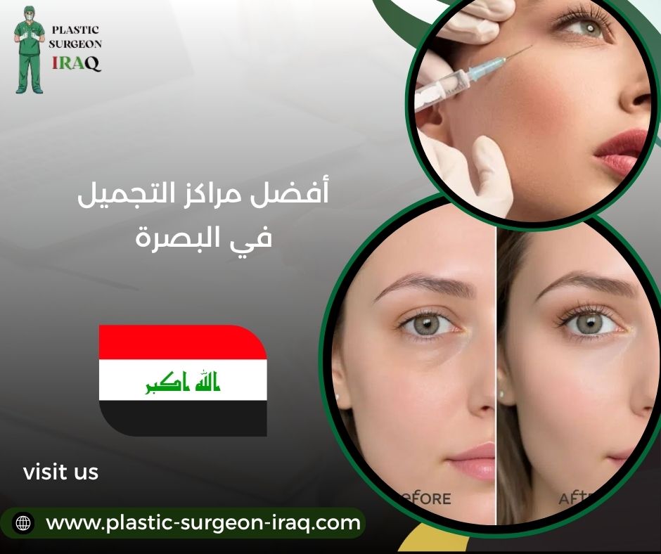 أفضل مراكز التجميل في البصرة