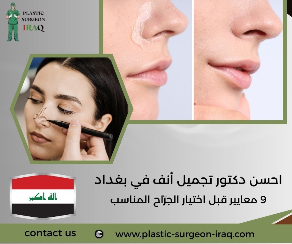 احسن دكتور تجميل أنف في بغداد