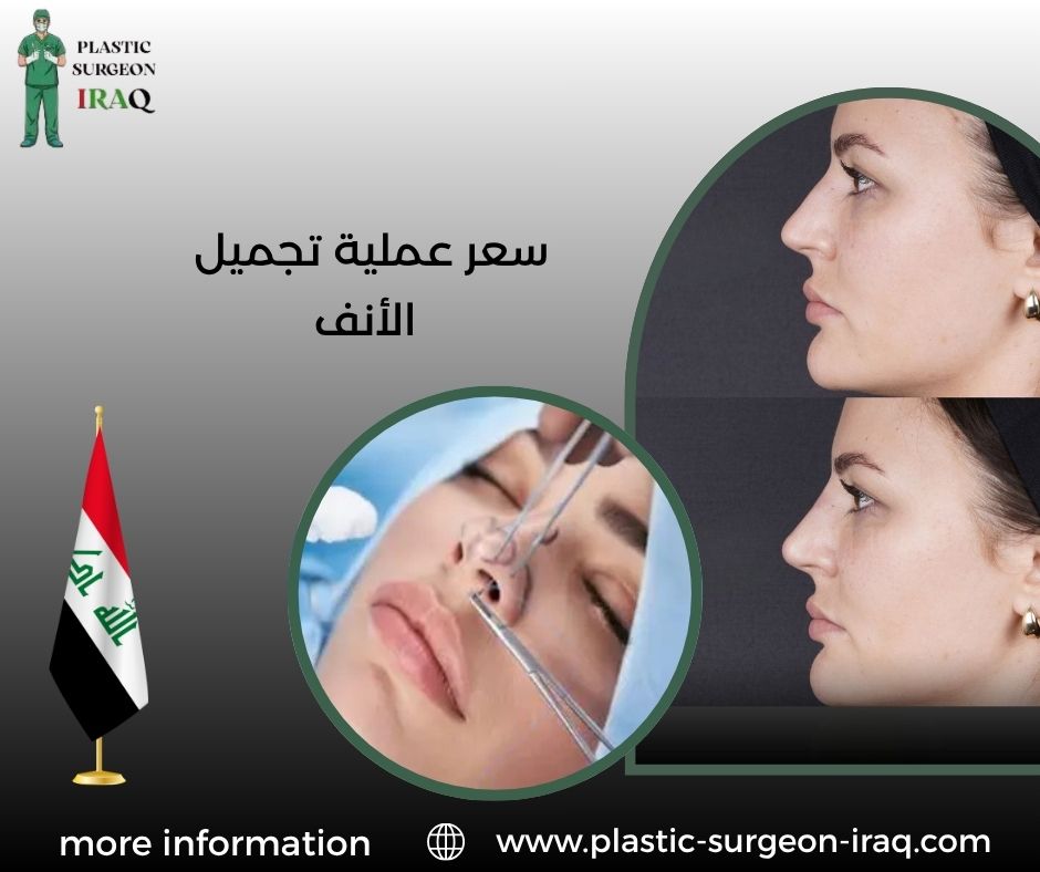 سعر عملية تجميل الأنف