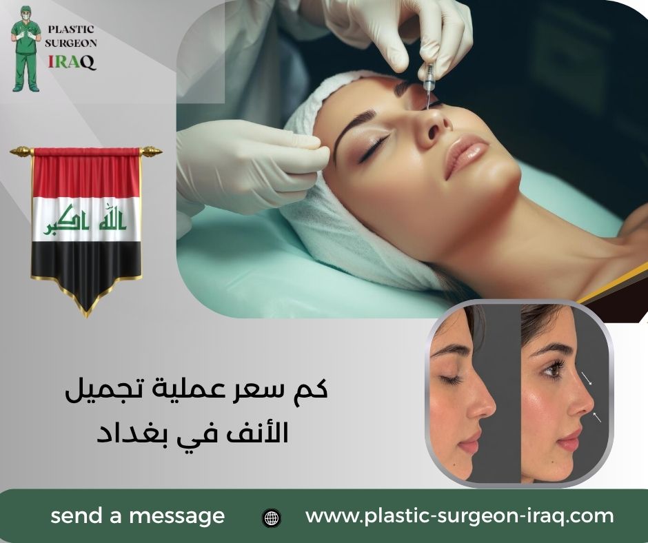 كم سعر عملية تجميل الأنف في بغداد