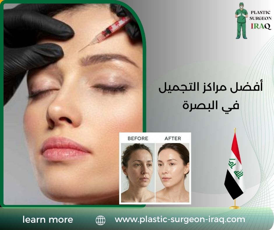 أفضل مراكز التجميل في البصرة