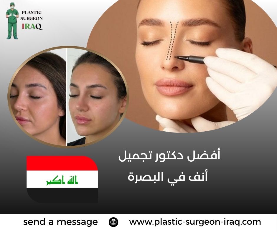 أفضل دكتور تجميل أنف في البصرة