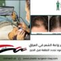 سعر زراعة الشعر في العراق