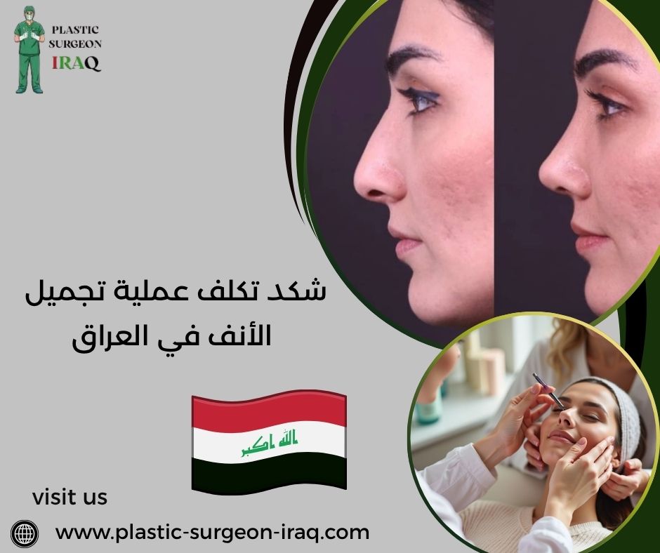 شكد تكلف عملية تجميل الأنف في العراق
