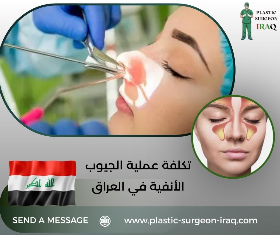 تكلفة عملية الجيوب الأنفية في العراق
