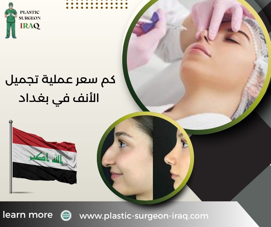 كم سعر عملية تجميل الأنف في بغداد