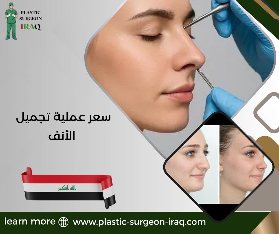 سعر عملية تجميل الأنف