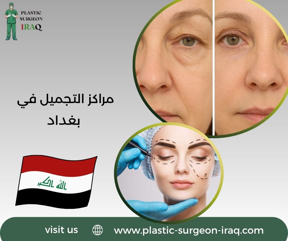 مراكز التجميل في بغداد