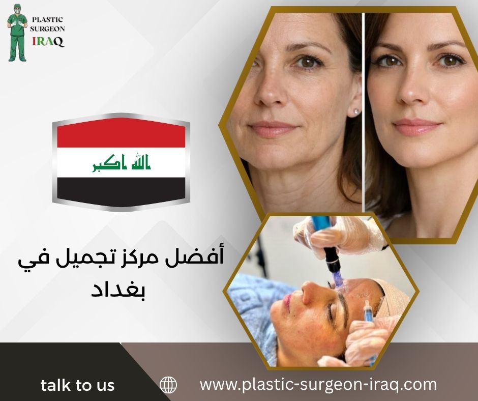 أفضل مركز تجميل في بغداد