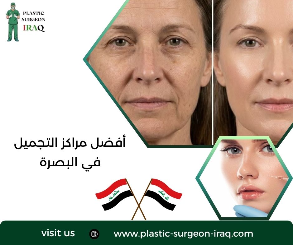 أفضل مراكز التجميل في البصرة